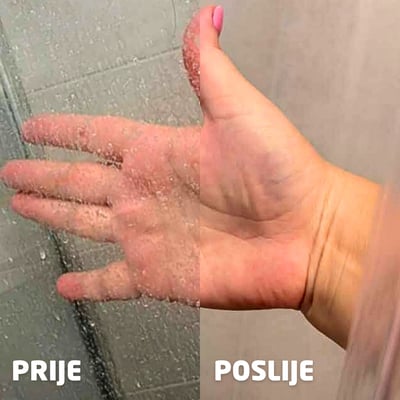 Kamenac u tušu – prije i poslije