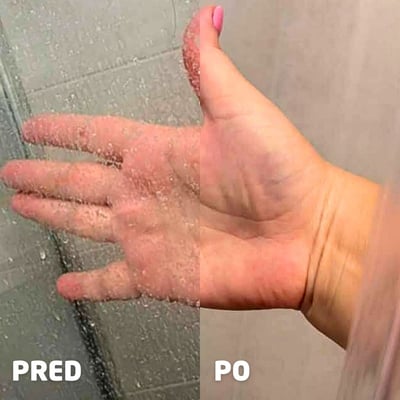 Vodný kameň v sprche – pred a po
